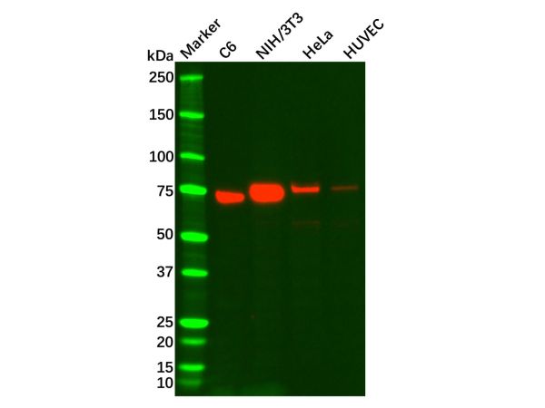 Recombinant Caldesmon/CDM Antibody,Recombinant Caldesmon/CDM Antibody