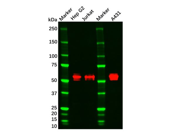 CaMKII Mouse mAb,CaMKII Mouse mAb