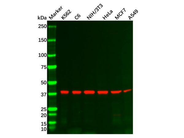 Recombinant PRKACA Antibody,Recombinant PRKACA Antibody