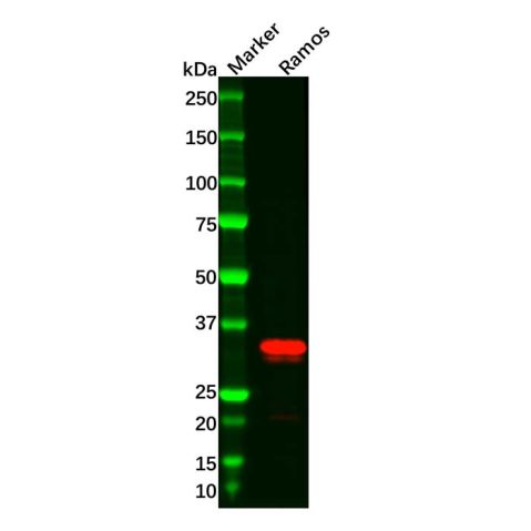 Recombinant CD20 Antibody,Recombinant CD20 Antibody