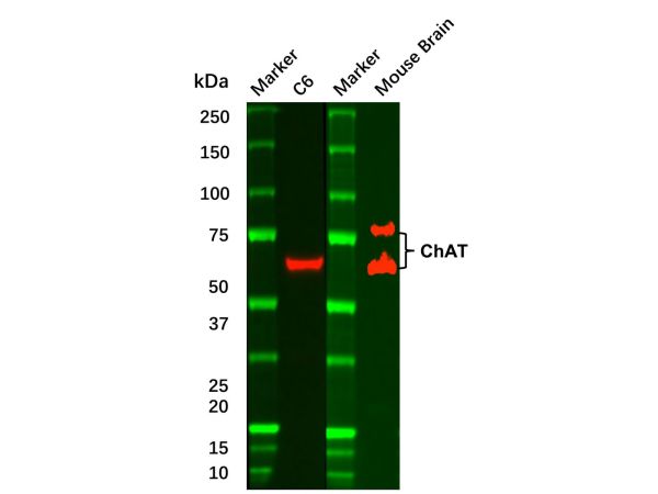 Recombinant Choline Acetyltransferase Antibody,Recombinant Choline Acetyltransferase Antibody