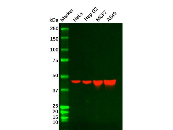 Recombinant Cytokeratin 18 Antibody,Recombinant Cytokeratin 18 Antibody