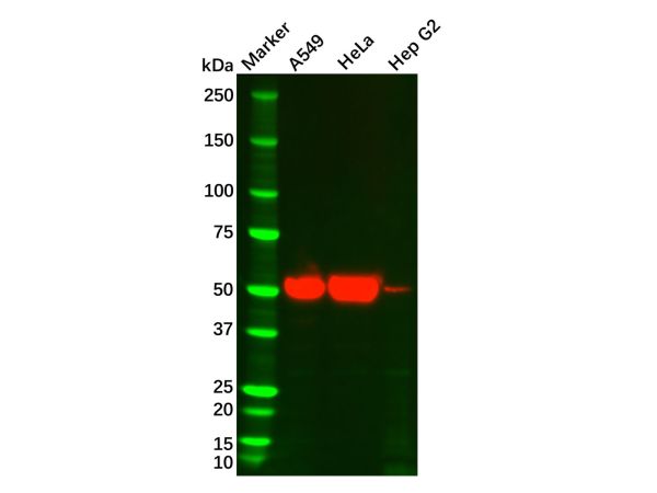 Cytokeratin 7 Mouse mAb,Cytokeratin 7 Mouse mAb