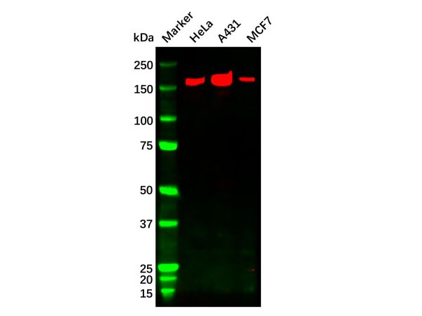 ErbB2/Her2 Mouse mAb,ErbB2/Her2 Mouse mAb