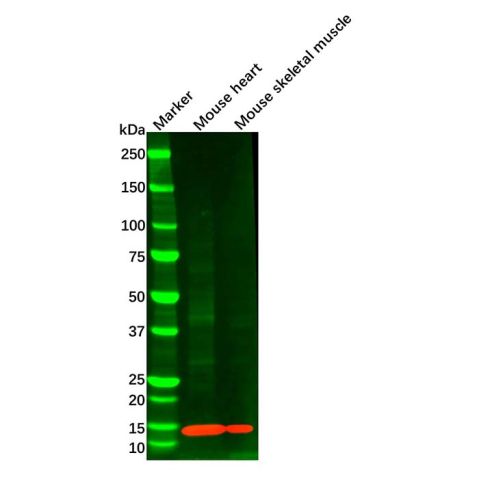 FABP4 Mouse mAb,FABP4 Mouse mAb