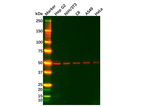 Recombinant FADS1 Antibody,Recombinant FADS1 Antibody