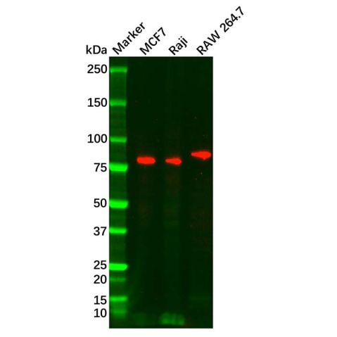 FOXP1 Mouse mAb,Anti-FOXP1 antibody