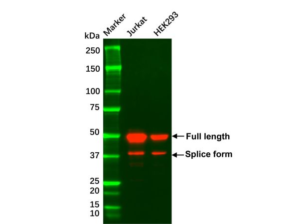 Recombinant GATA3 Antibody,Recombinant GATA3 Antibody