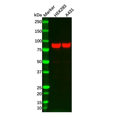 Recombinant Glycogen synthase 1/GYS1 Antibody,Recombinant Glycogen synthase 1/GYS1 Antibody