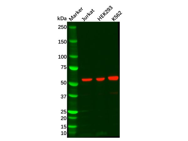 Recombinant P70 S6 Kinase beta/SRK Antibody,Recombinant P70 S6 Kinase beta/SRK Antibody