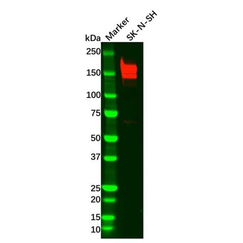 Recombinant PDGFR beta Antibody,Recombinant PDGFR beta Antibody