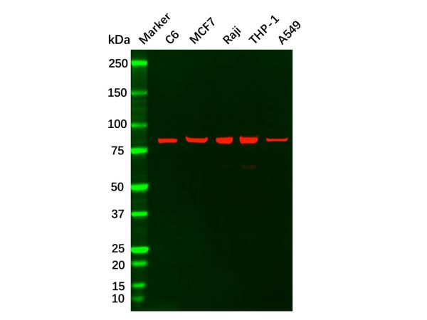 Recombinant PI 3 Kinase p85 alpha ?Antibody,Recombinant PI 3 Kinase p85 alpha ?Antibody