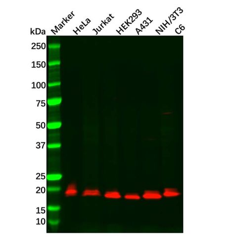 Recombinant Presenilin 1/PS-1 Antibody,Recombinant Presenilin 1/PS-1 Antibody