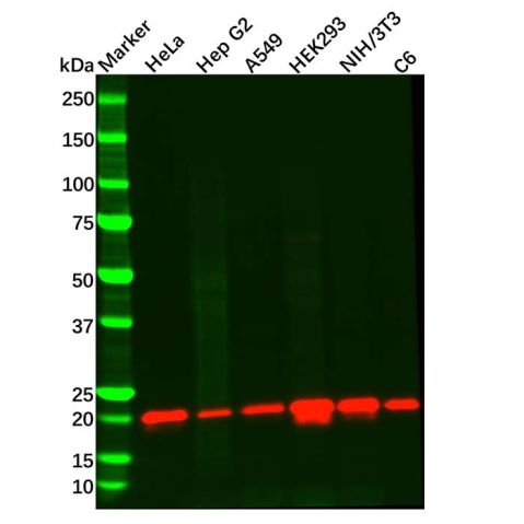 Recombinant Presenilin 2/AD5 Antibody,Recombinant Presenilin 2/AD5 Antibody