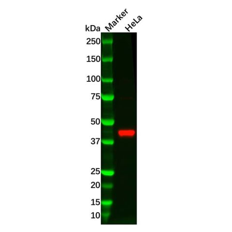 RRM2 Antibody,RRM2 Antibody