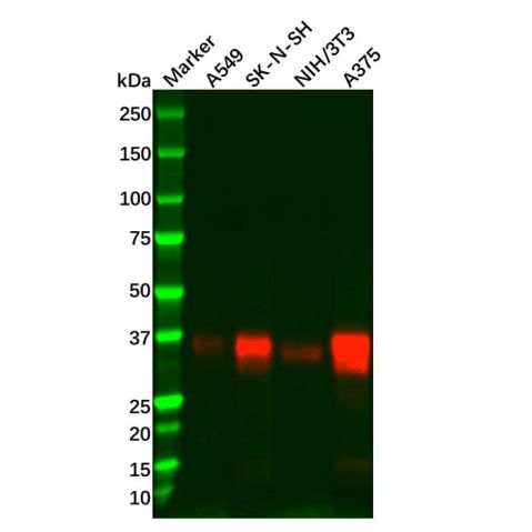 Recombinant SFRP1 Antibody,Recombinant SFRP1 Antibody