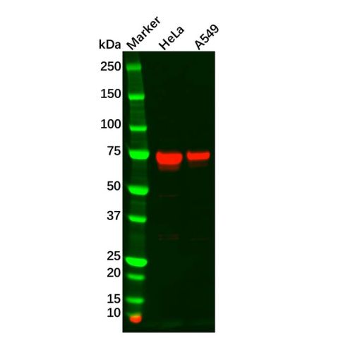 TGFBI Antibody,TGFBI Antibody