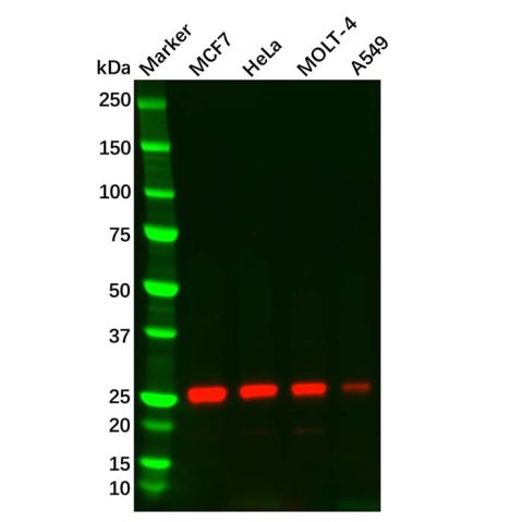 Thymidine Kinase 1/TK1 Mouse mAb,Thymidine Kinase 1/TK1 Mouse mAb