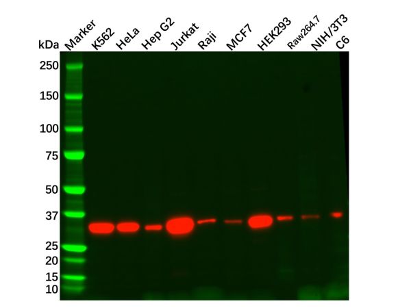 Recombinant Thymidylate Synthase Antibody,Recombinant Thymidylate Synthase Antibody