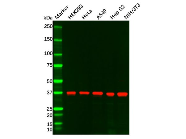 Recombinant TTF1 Antibody,Recombinant TTF1 Antibody