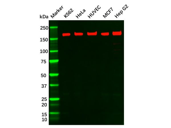 Recombinant VEGF Receptor 1 Antibody,Recombinant VEGF Receptor 1 Antibody