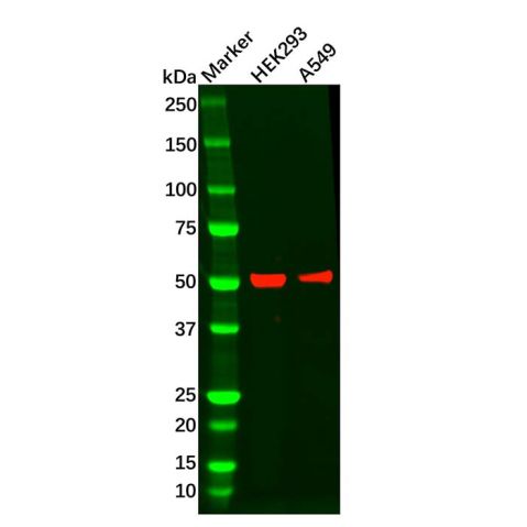 Recombinant Wilms Tumor Protein Antibody,Recombinant Wilms Tumor Protein Antibody