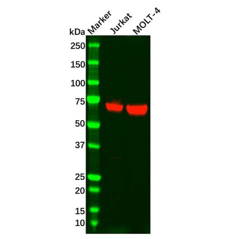 Recombinant ZAP70 Antibody,Recombinant ZAP70 Antibody