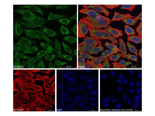 Goat Anti-Rabbit IgG H&L (Alexa Fluor? 488),Goat Anti-Rabbit IgG H&L (Alexa Fluor? 488)