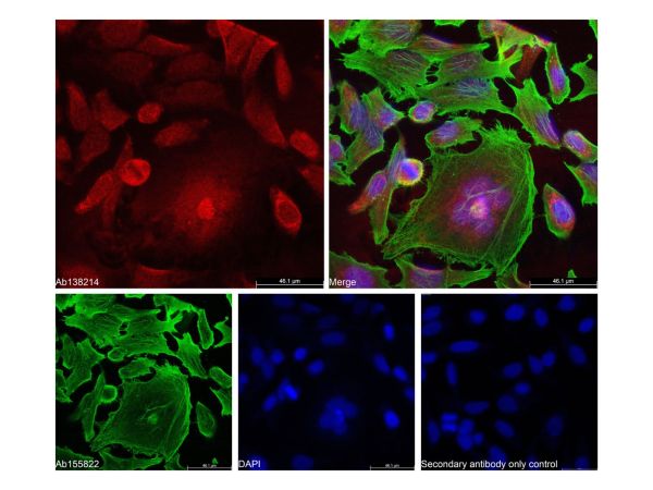 Goat Anti-Rabbit IgG H&L (Alexa Fluor? 594),Goat Anti-Rabbit IgG H&L (Alexa Fluor? 594)