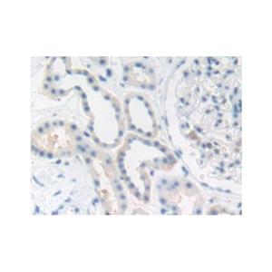 Carcino Embryonic Antigen CEA Antibody,Carcino Embryonic Antigen CEA Antibody