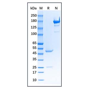 Myeloperoxidase Mouse mAb,Myeloperoxidase Mouse mAb