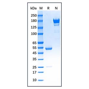 Myeloperoxidase Mouse mAb,Myeloperoxidase Mouse mAb