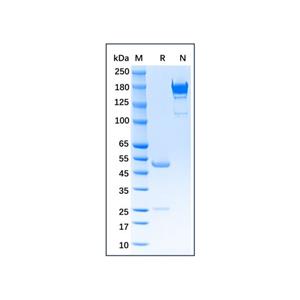 GDF15 Mouse mAb,GDF15 Mouse mAb