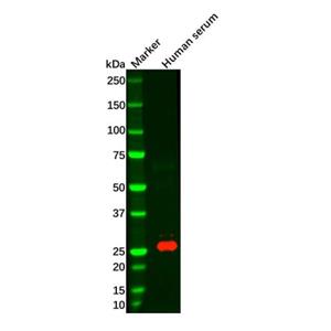 aladdin 阿拉丁 Ab008399 Recombinant Kappa Light Chain Antibody Recombinant (R02-7H3); Rabbit anti Human Kappa Light Chain Antibody; WB, IHC, ICC, IF; Unconjugated