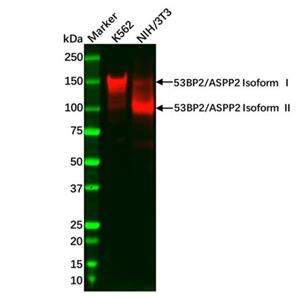 aladdin 阿拉丁 Ab086727 Recombinant 53BP2/ASPP2 Antibody Recombinant (R09-1B5); Rabbit anti Human 53BP2/ASPP2 Antibody; WB; Unconjugated