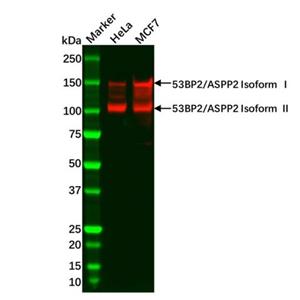Recombinant 53BP2/ASPP2 Antibody,Recombinant 53BP2/ASPP2 Antibody