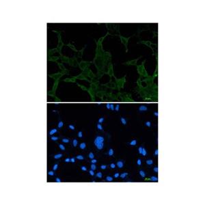 Recombinant ACADM/MCAD Antibody,Recombinant ACADM/MCAD Antibody