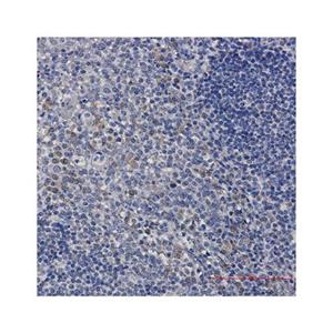 Recombinant ACADM/MCAD Antibody,Recombinant ACADM/MCAD Antibody