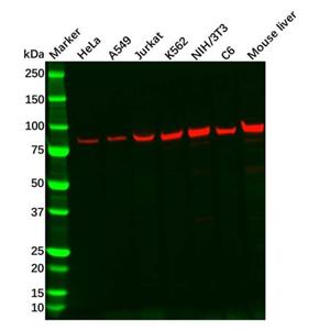 aladdin 阿拉丁 Ab087199 Recombinant Aconitase 2 Antibody Recombinant (R07-7A1); Rabbit anti Human Aconitase 2 Antibody; WB, IHC, ICC, IF; Unconjugated