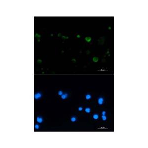 Recombinant Aconitase 2 Antibody,Recombinant Aconitase 2 Antibody