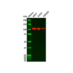 aladdin 阿拉丁 Ab087287 NOTCH1 Antibody pAb; Rabbit anti Human NOTCH1 Antibody; WB, IHC, ICC, IF; Unconjugated