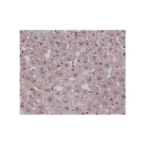 NOTCH1 Antibody,NOTCH1 Antibody