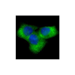 NOTCH1 Antibody,NOTCH1 Antibody