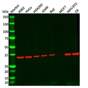 aladdin 阿拉丁 Ab087488 Recombinant Adenosine A1 Receptor Antibody Recombinant (R05-9E6); Rabbit anti Human Adenosine A1 Receptor Antibody; WB, ICC, IF; Unconjugated