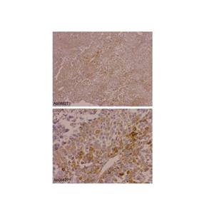 aladdin 阿拉丁 Ab088271 Recombinant alpha 1 Fetoprotein Antibody Recombinant (RM1011), Recombinant Anti-alpha 1 Fetoprotein Antibody; IHC, IF/ICC, Flow, WB, IP, ELISA; Unconjugated