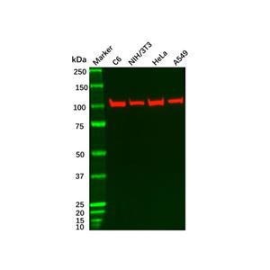 aladdin 阿拉丁 Ab088349 Recombinant ACTN4 Antibody Recombinant (R06-3D7); Rabbit anti Human ACTN4 Antibody; WB, ICC, IF; Unconjugated