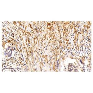 alpha-Smooth Muscle Actin Mouse mAb,alpha-Smooth Muscle Actin Mouse mAb