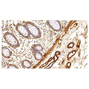 alpha-Smooth Muscle Actin Mouse mAb,alpha-Smooth Muscle Actin Mouse mAb