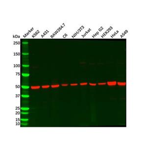 aladdin 阿拉丁 Ab088473 Recombinant Alpha Tubulin Antibody Recombinant (R02-2H3); Rabbit anti Human Alpha Tubulin Antibody; WB, IHC, ICC, IF; Unconjugated