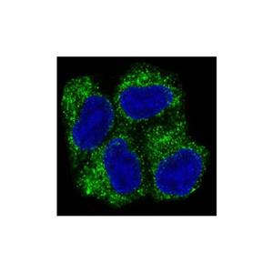 Recombinant AMPK alpha 1 Antibody,Recombinant AMPK alpha 1 Antibody